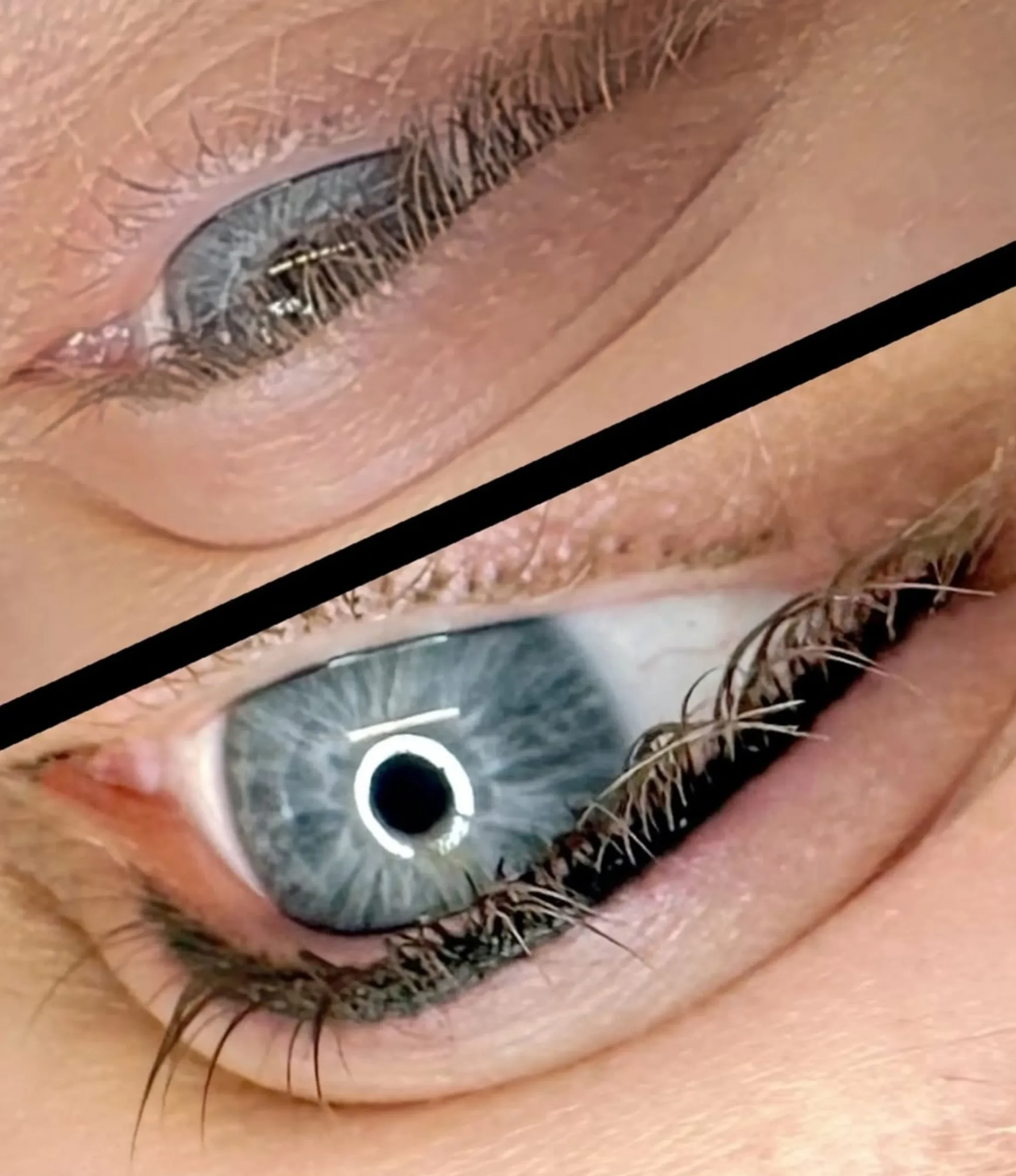 cosmetic tattooing eyeliner